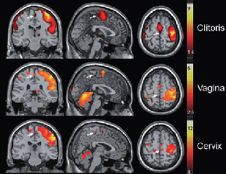 fMRI of the Brain During Sex